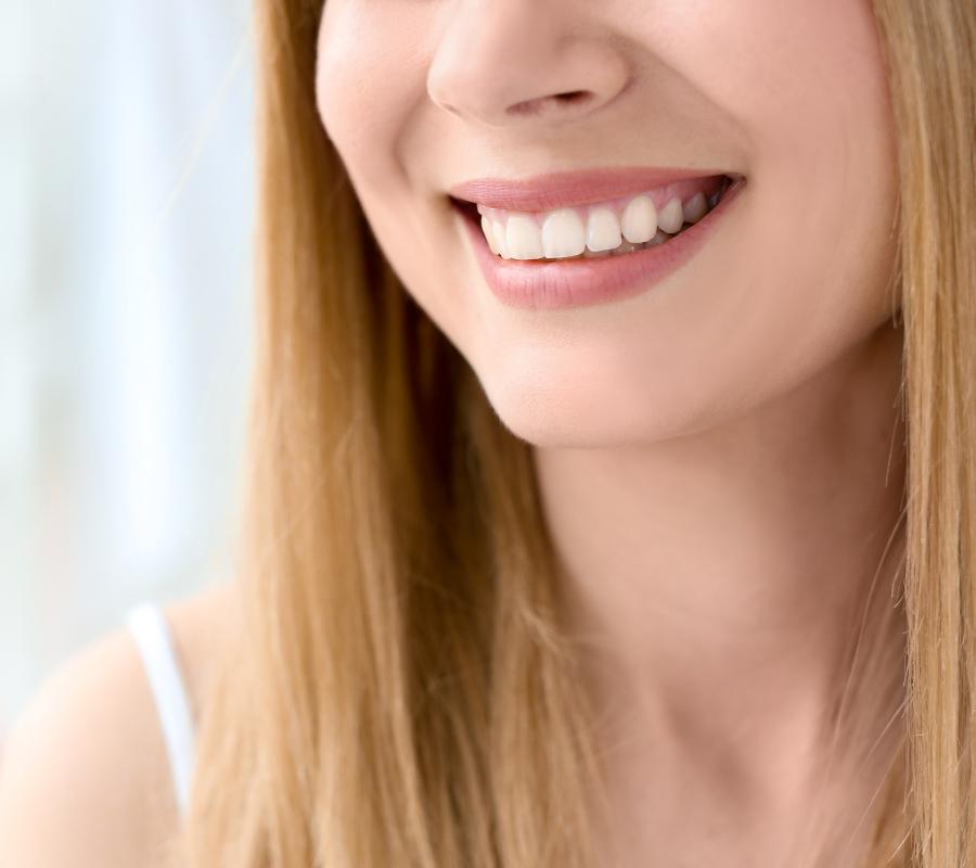 Patient smiling teeth after taking wisdom teeth removal services