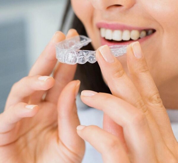 Invisalign in Tansley ON with clear aligners for subtle smile correction Invisalign in Tansley ON with clear aligners for subtle smile correction