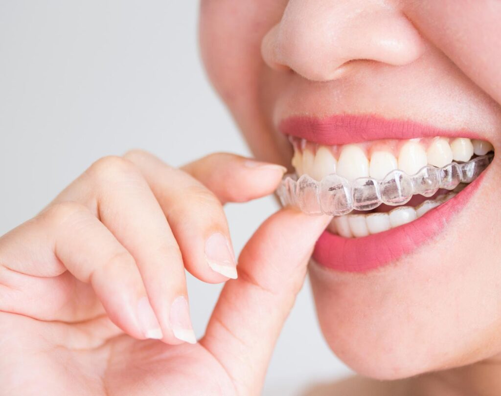 Invisalign services in Mountain Gardens ON with digital smile design